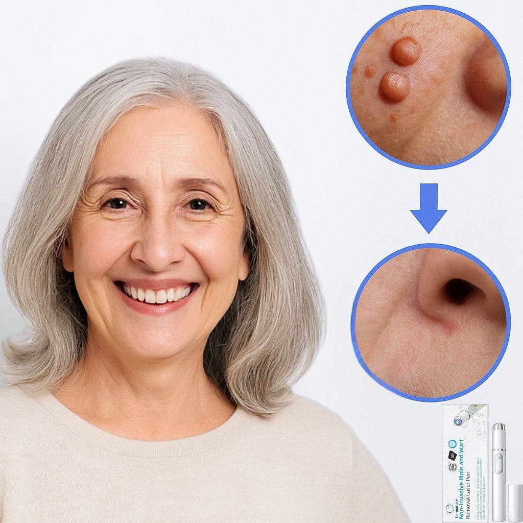 DermaLase™