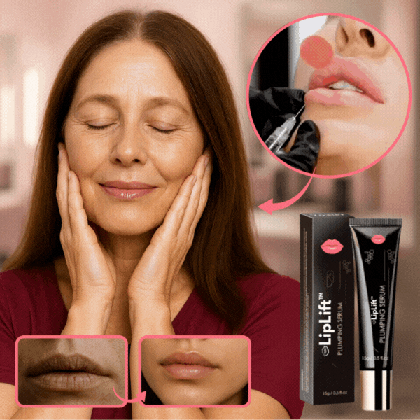 LipLift™