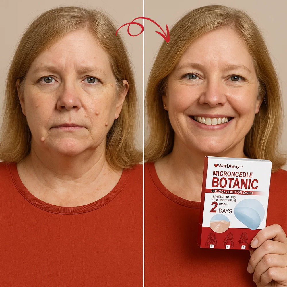 WartAway™