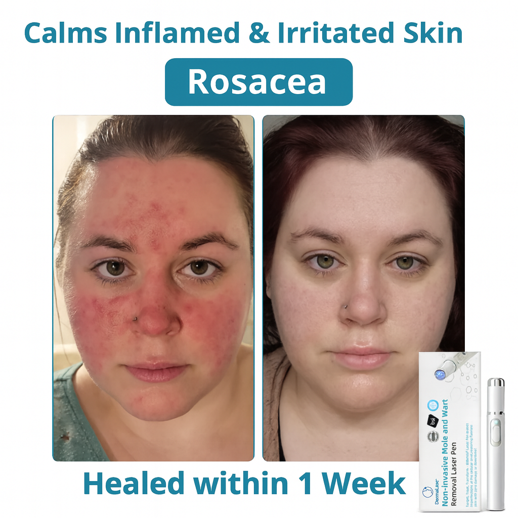 2x DermaLase™