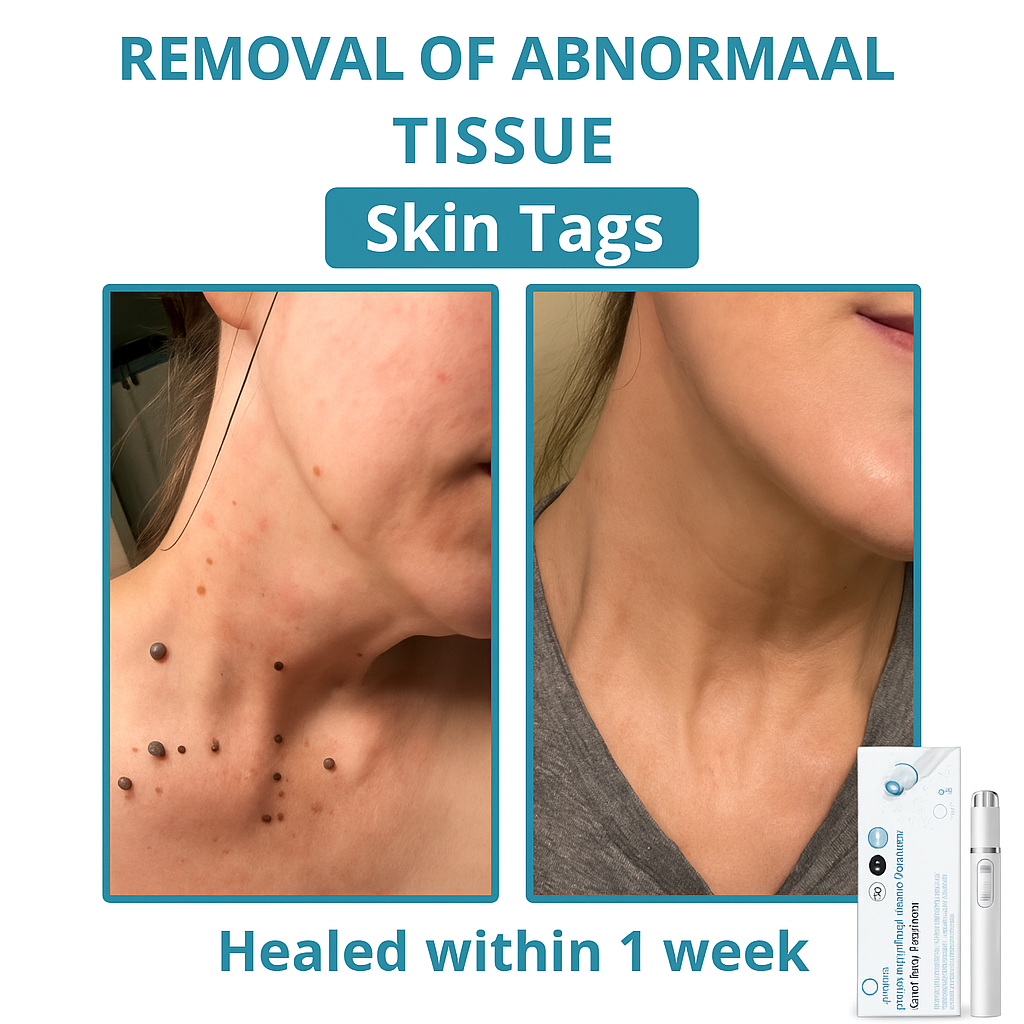 2x DermaLase™