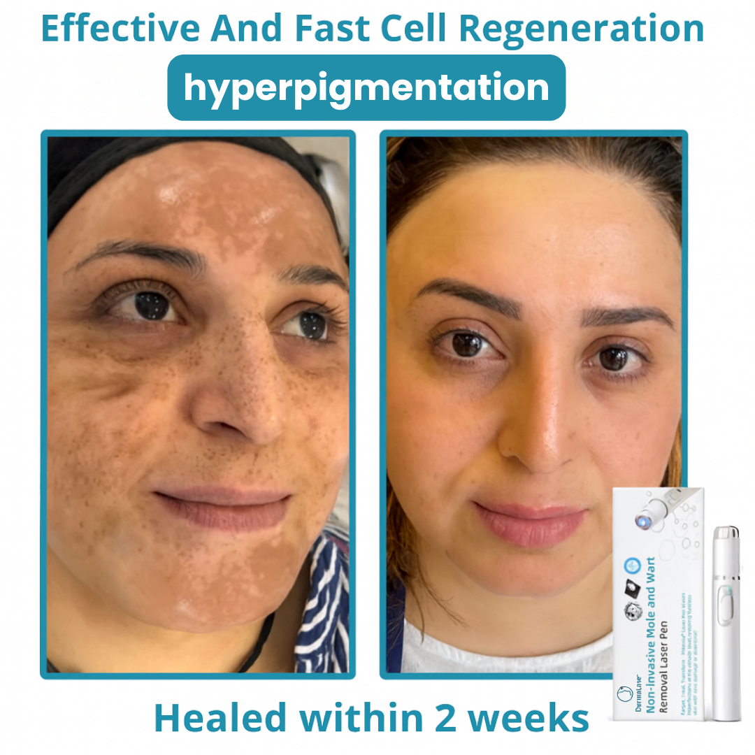 2x DermaLase™
